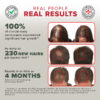 real people real result