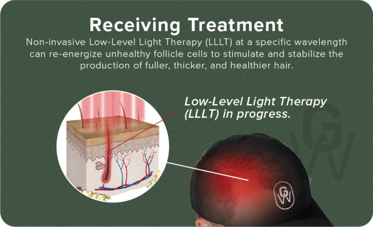 laser caps for hair loss