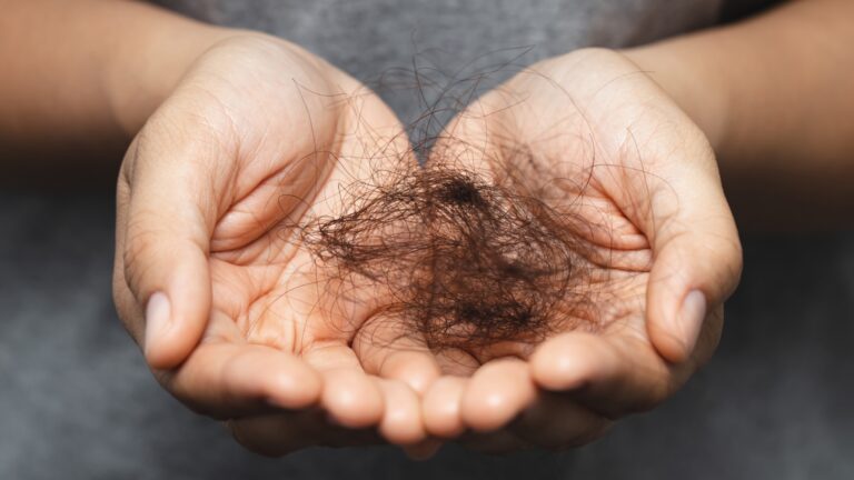 hair loss