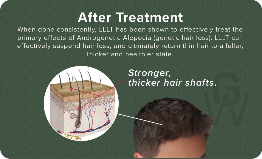 After Hair Growth