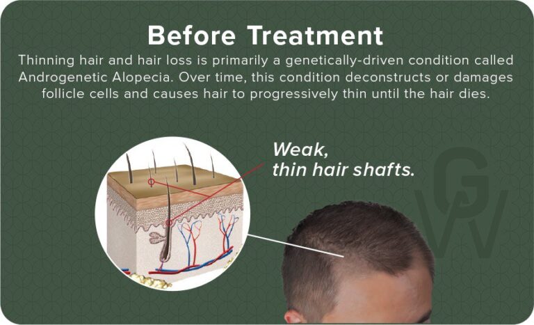 After Hair regrowth Treatment