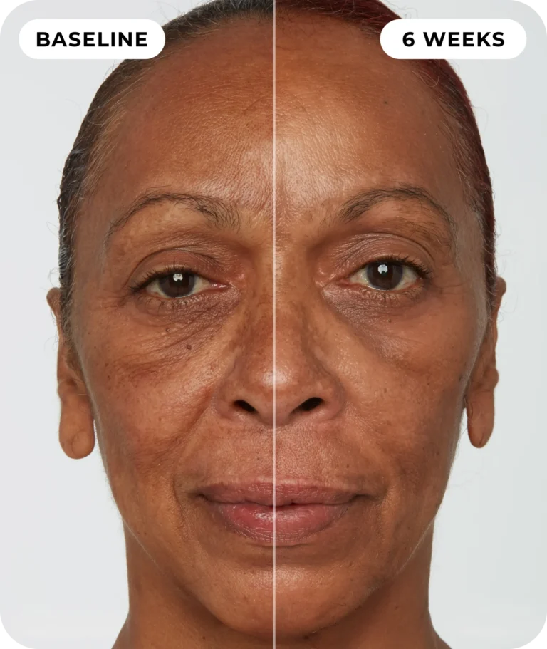 00IdermaPage_SpliFaceSetup_01