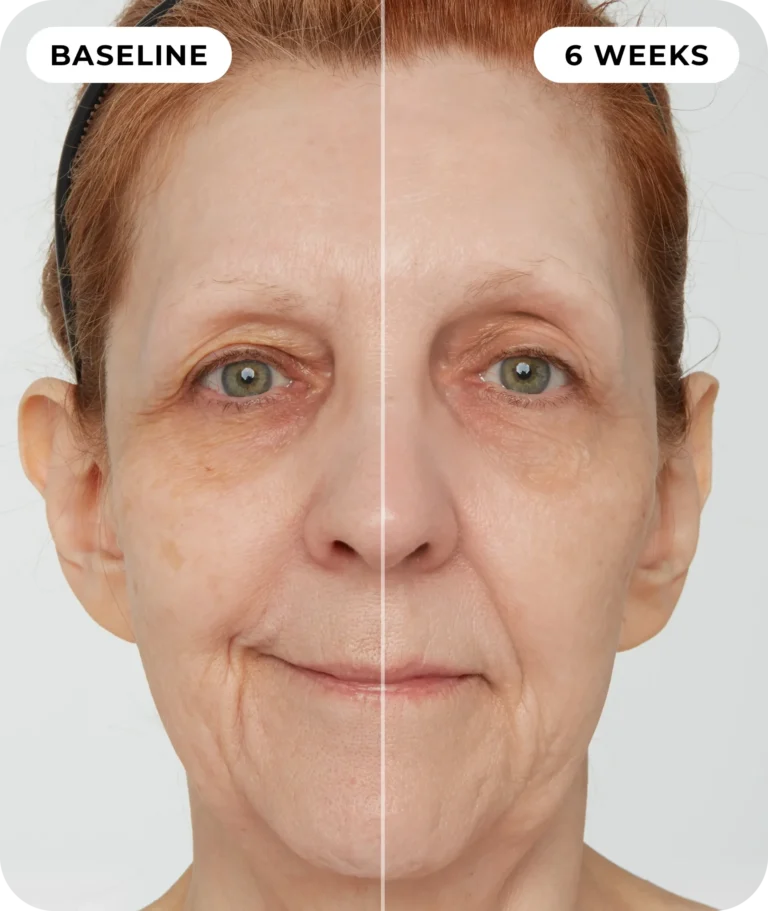 00IdermaPage_SpliFaceSetup_02