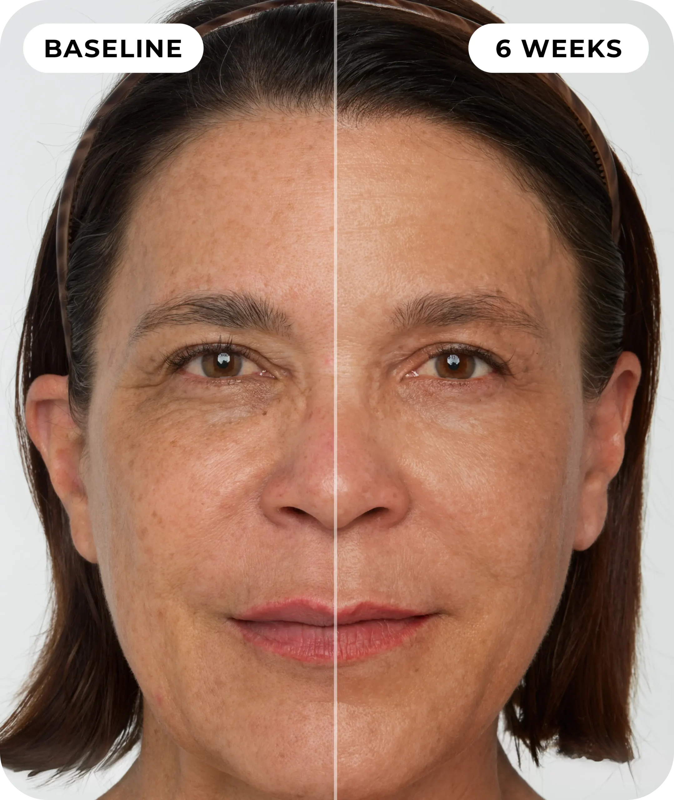 00IdermaPage_SpliFaceSetup_03 00IdermaPage_SpliFaceSetup_03