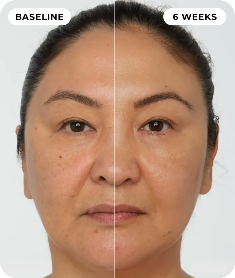 00IdermaPage_SpliFaceSetup_04