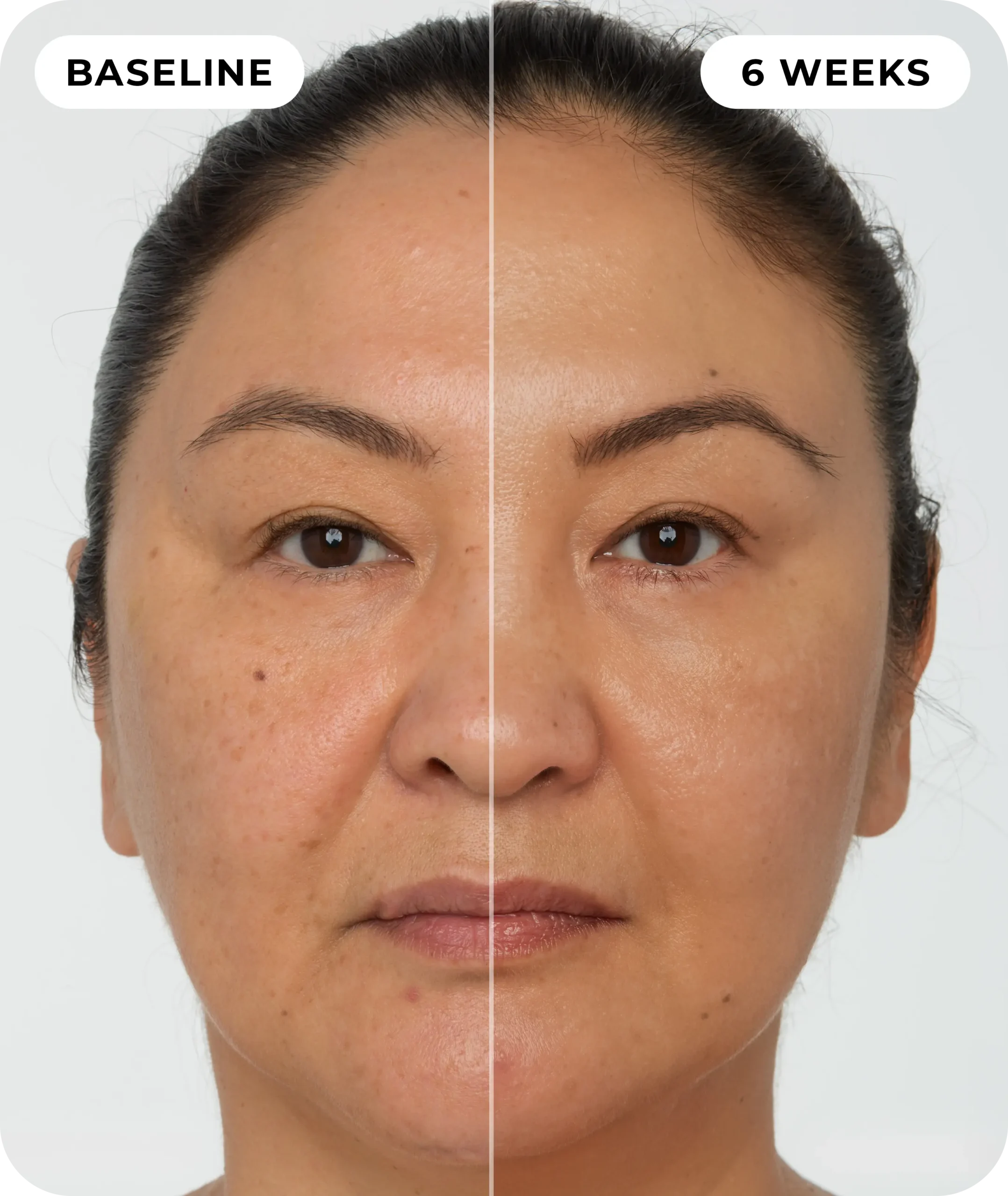 00IdermaPage_SpliFaceSetup_04 00IdermaPage_SpliFaceSetup_04