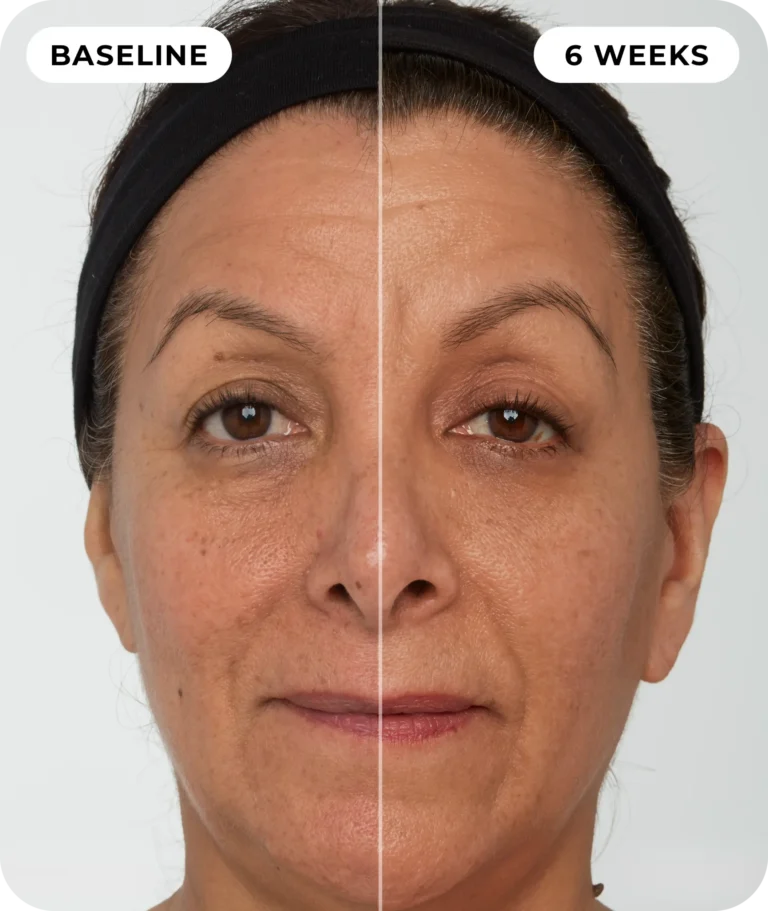 00IdermaPage_SpliFaceSetup_06