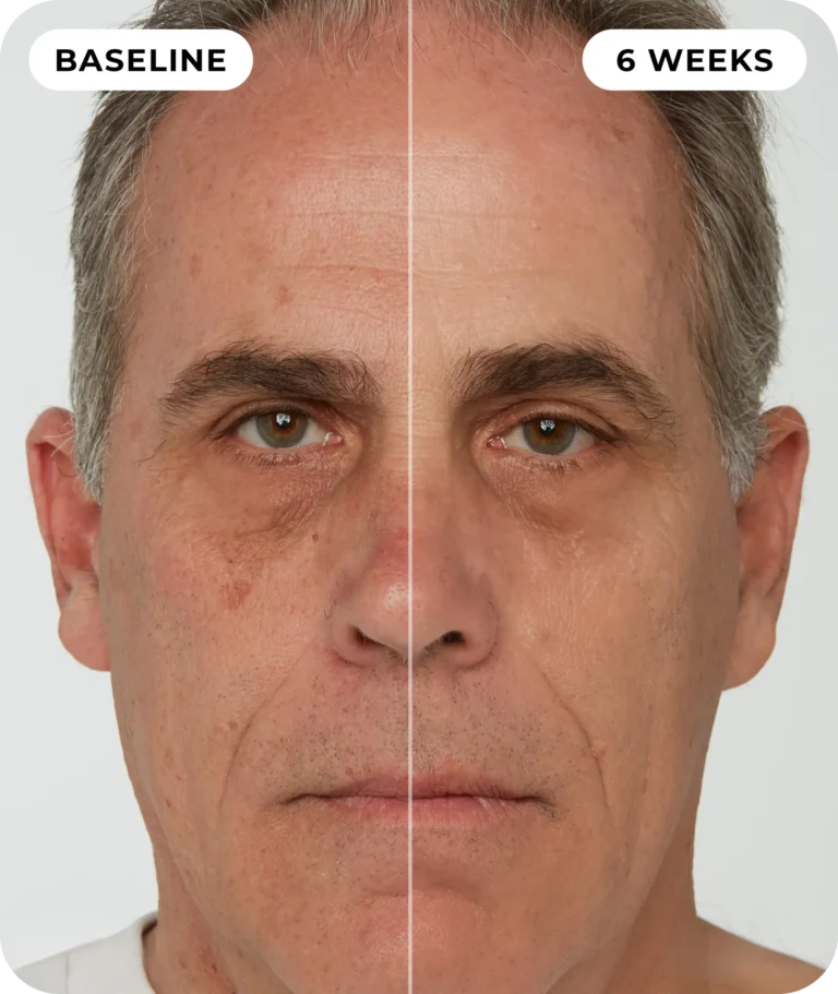 00IdermaPage_SpliFaceSetup_07