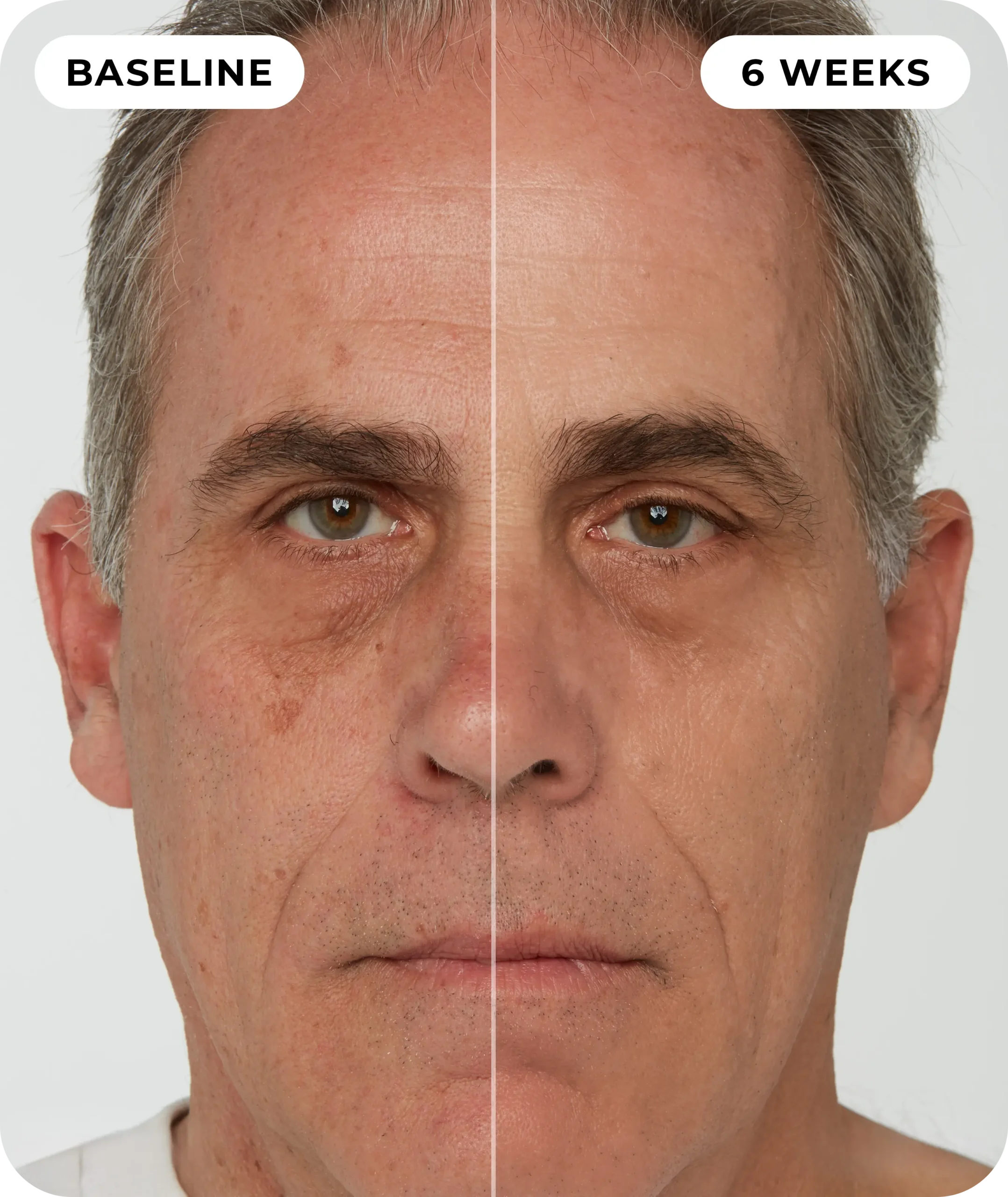 00IdermaPage_SpliFaceSetup_07 00IdermaPage_SpliFaceSetup_07
