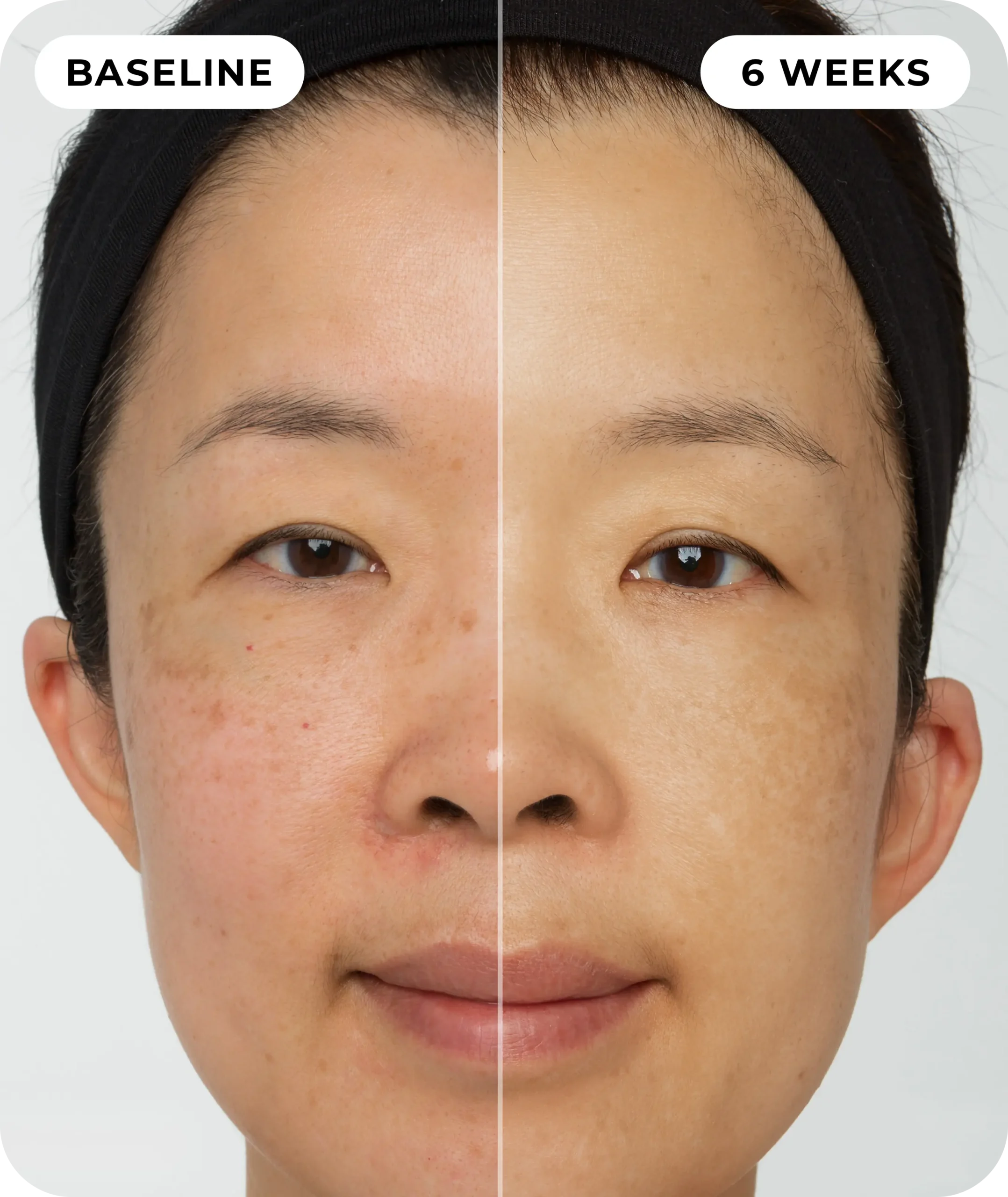 00IdermaPage_SpliFaceSetup_08 00IdermaPage_SpliFaceSetup_08