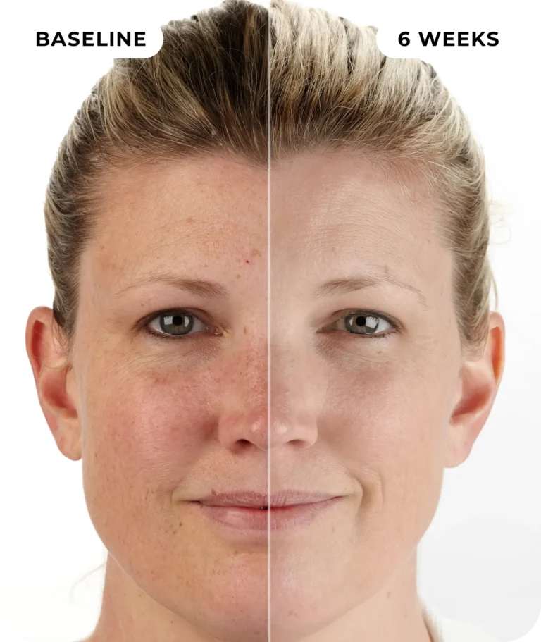 00IdermaPage_SpliFaceSetup_10