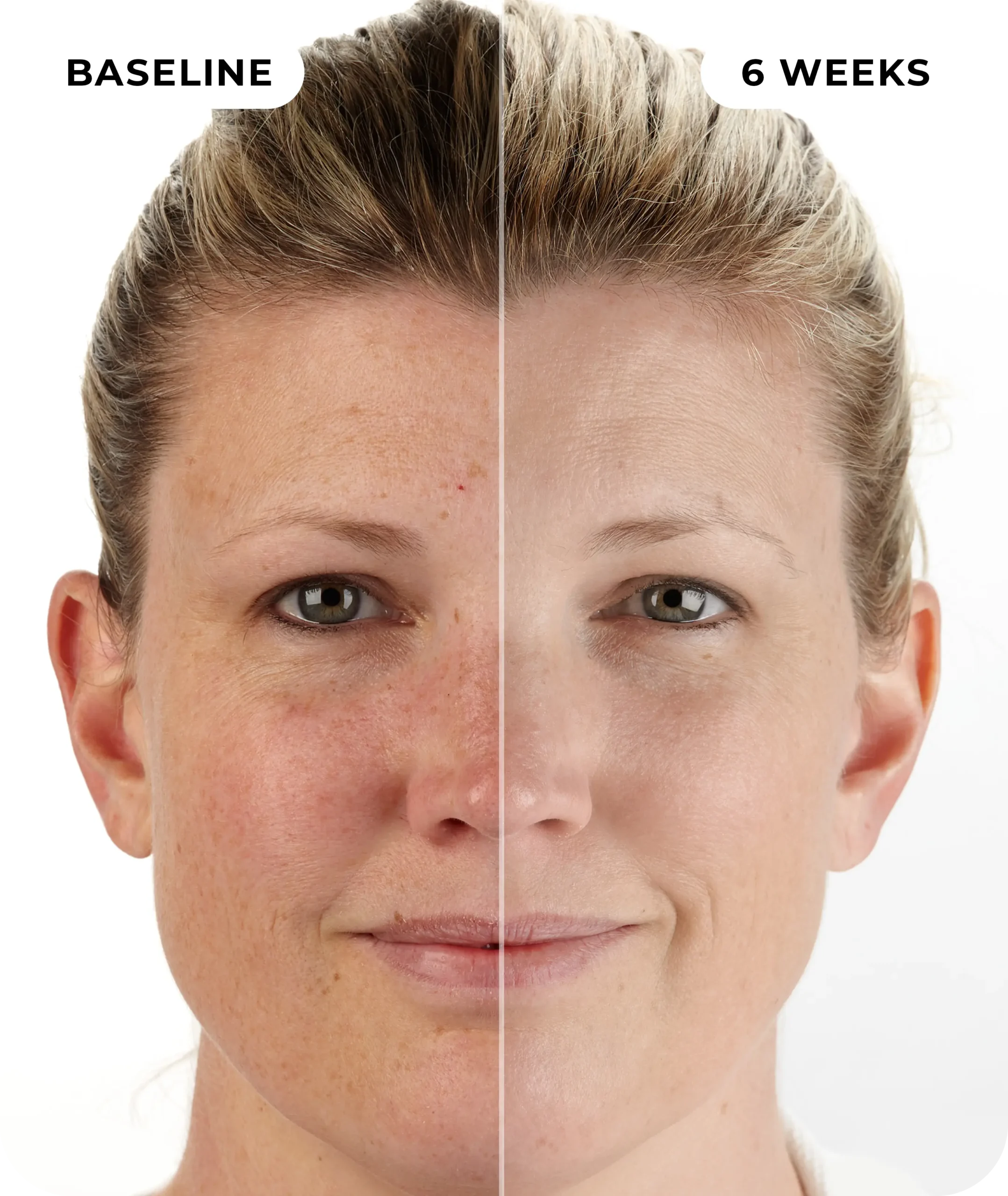 00IdermaPage_SpliFaceSetup_10 00IdermaPage_SpliFaceSetup_10
