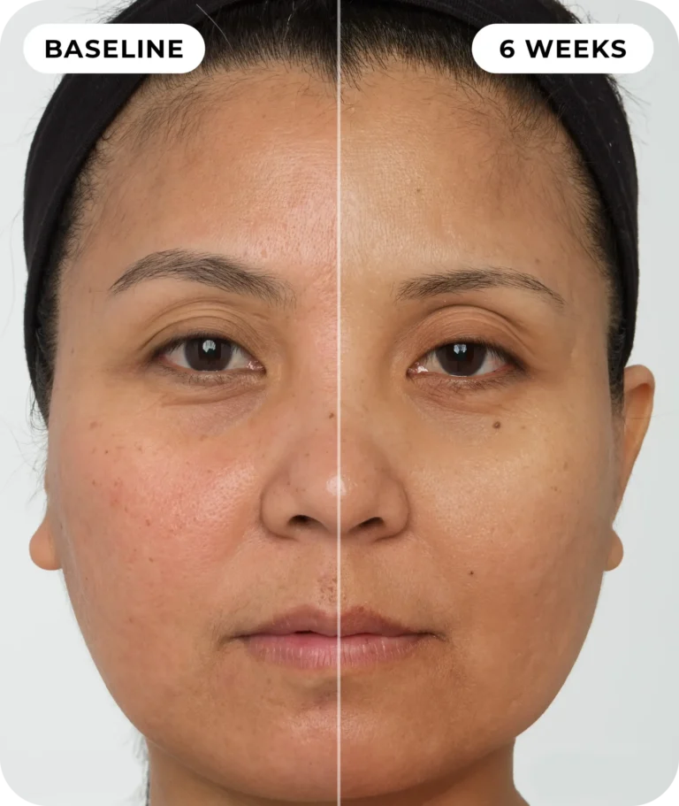 00IdermaPage_SpliFaceSetup_11