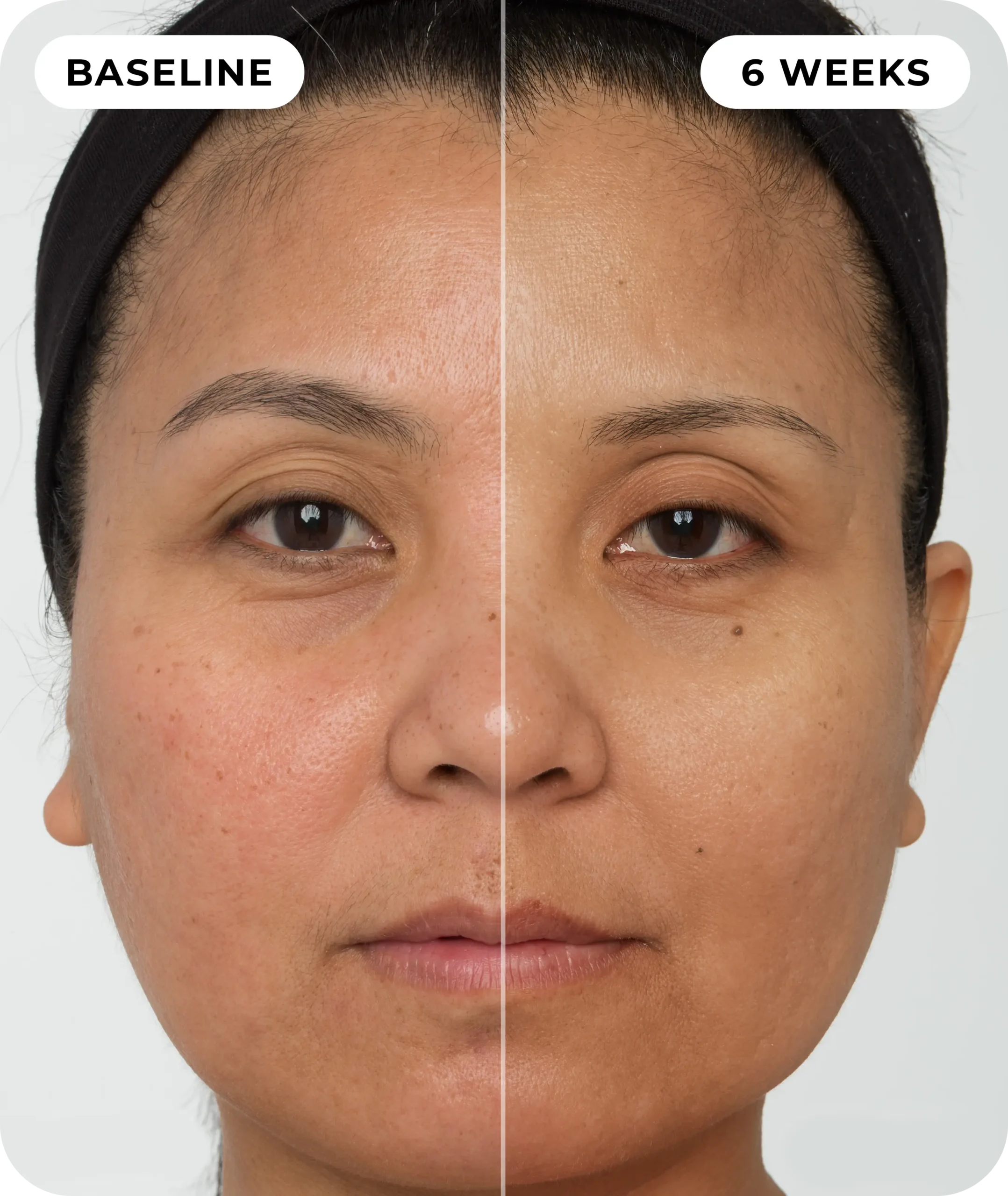 00IdermaPage_SpliFaceSetup_11 00IdermaPage_SpliFaceSetup_11