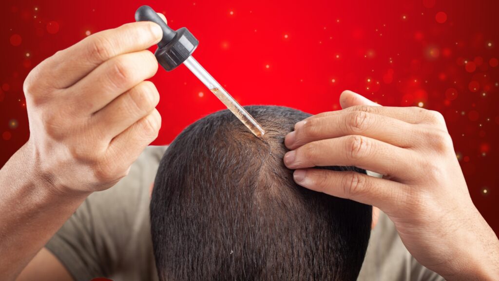 Minoxidil treatment with red light therapy