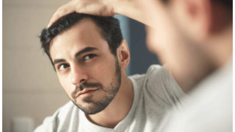 Hair loss in men