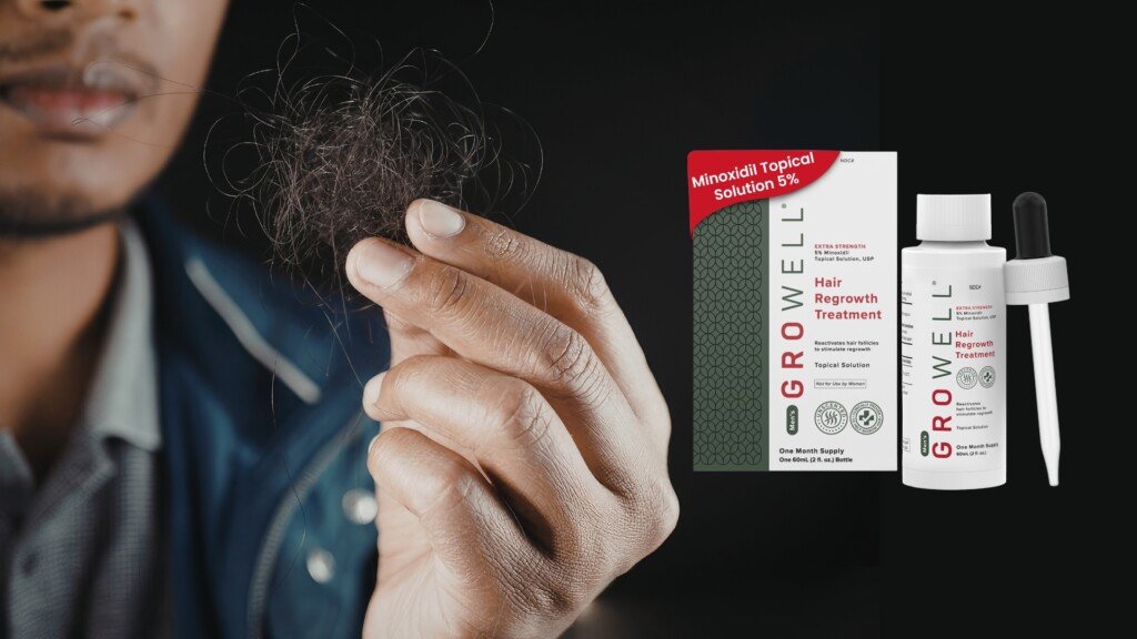 man holding lost hair next to minoxidil