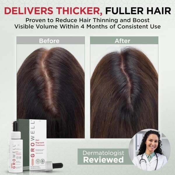 GroWell Minoxidil for women