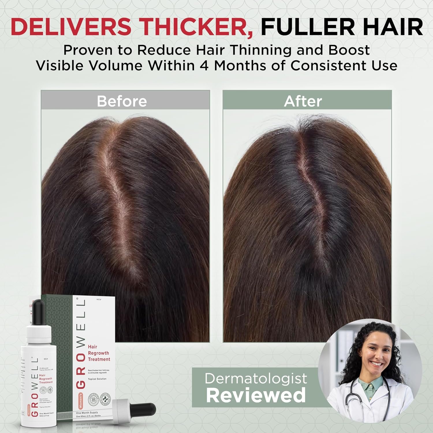 GroWell Minoxidil for women