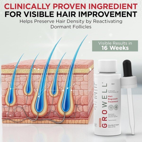 GroWell 2% topical minoxidil for women — bottle and dropper applicator