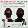 Topical minoxidil for men applied to scalp with dropper — before/after